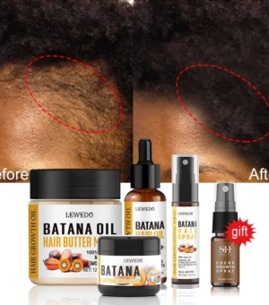 Fast Hair Growth Oil Africa Crazy Traction Alopecia batana Hair Mask Anti Hair Break Hair Strengthener Hair Loss Treatment Spray